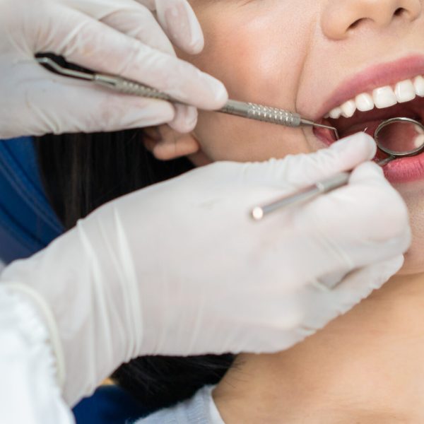 Close,Up,Of,Caucasian,Beautiful,Young,Girl,Patient's,Teeth,Open